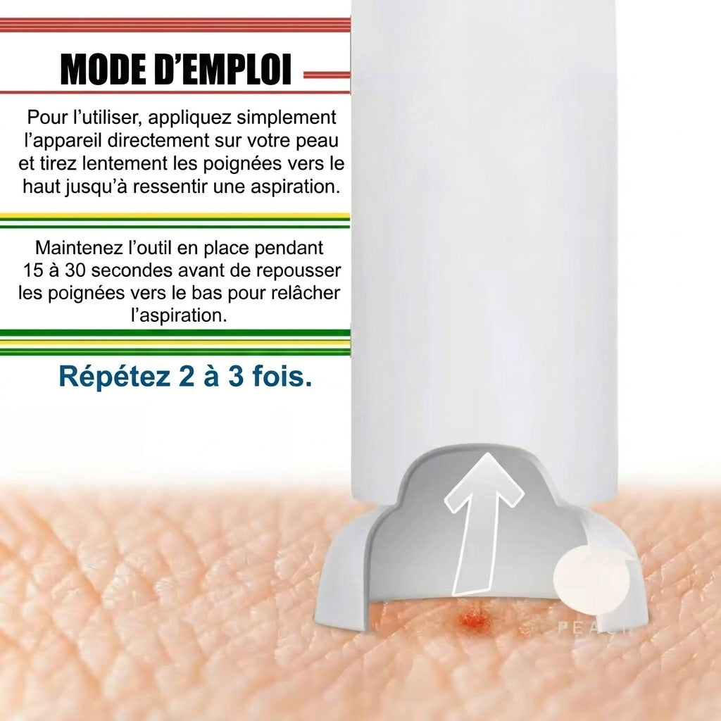 MoustiGo™ Extracteur de Venin Manuel — Aspire et Soulage les Piqûres en 30 Secondes